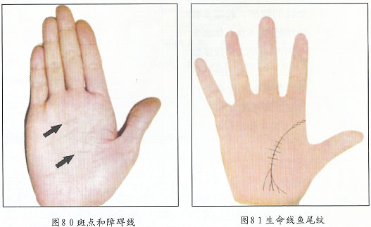 生命线上链条型手纹_生命线链状纹手相_生命线上的链形纹